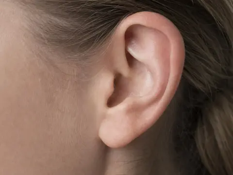 Kepçe Kulak Ameliyatı (Otoplasti): Süreç ve İyileşme — uygulama görseli